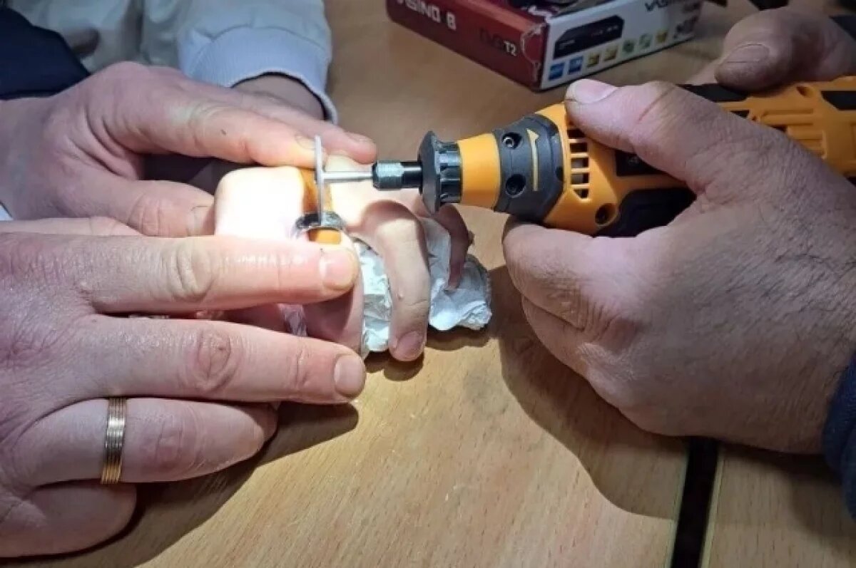    В Астрахани девочка едва не лишилась пальца, застряв в кольце