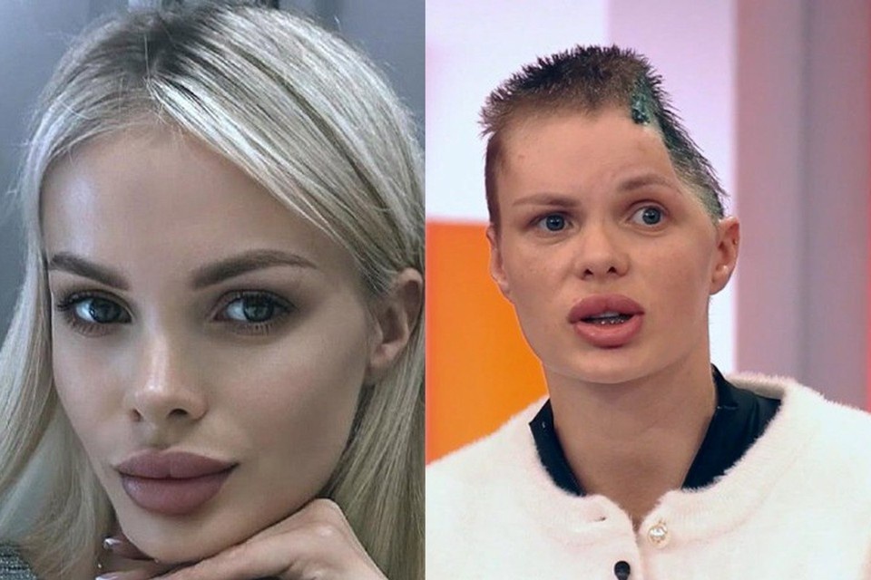    Анжелике предстоит новая операция. Фото: соцсети/скриншот видео