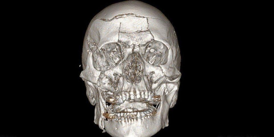    Пресс-служба Министерства здравоохранения Московской области