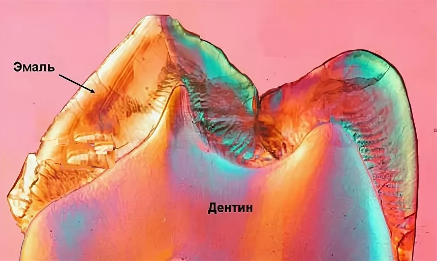 Разная толщина и структура эмали
