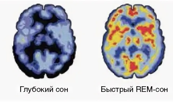 Схема работы мозга в фазе быстрого и глубокого сна. 