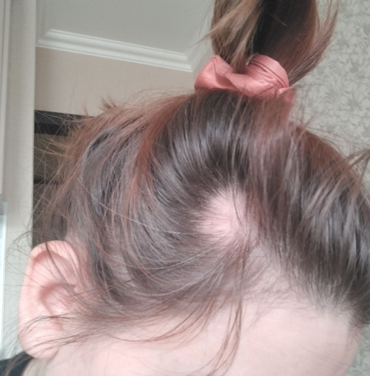 7 мая, первый очаг у виска