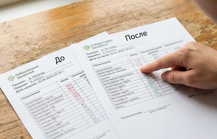 Через месяц муж спросил: «Что с тобой случилось?» Я молча показала ему два анализа — до и после