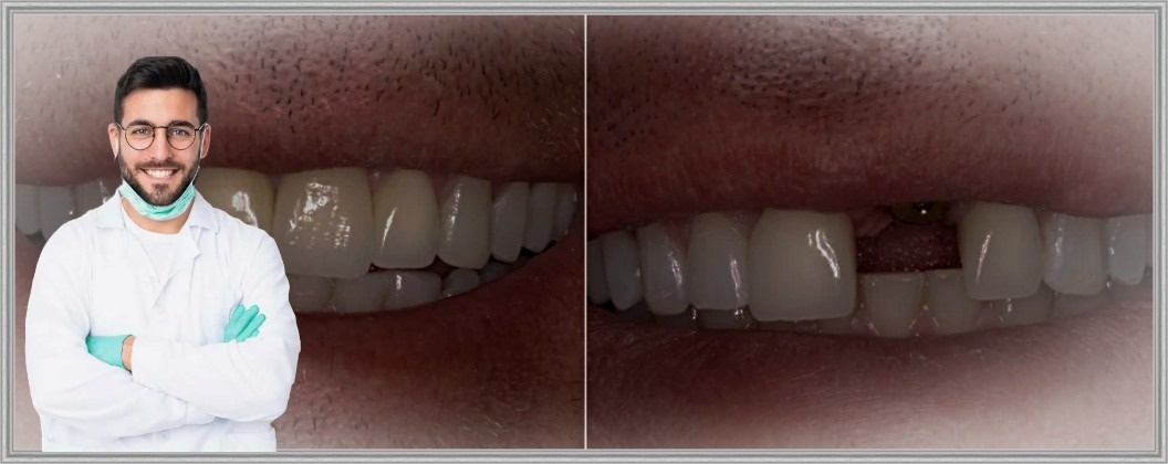 Его рассказ я запомнил надолго, потому что в нем было слишком много типичных ошибок, за которые платит не клиника, а человек в кресле.