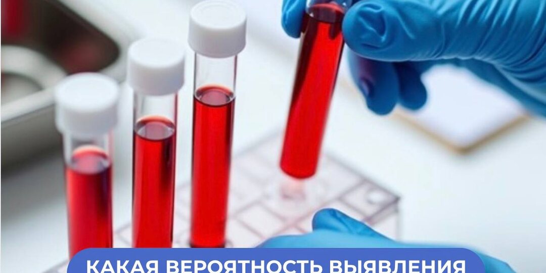 Какая вероятность выявления олигоклональных антител в ликворе у людей с РС