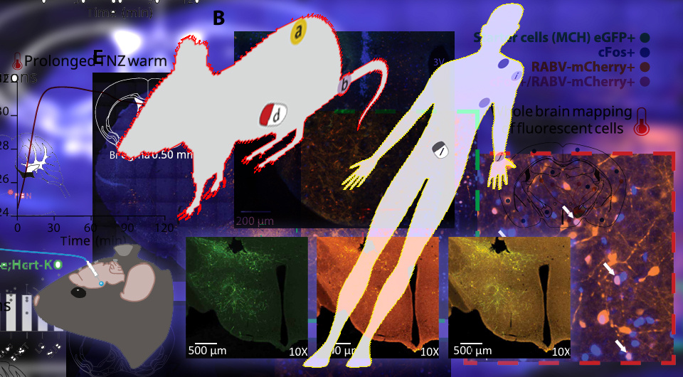   N +1; Viberti et al. / Science Translational Medicine, 2026