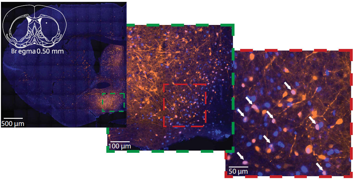   Viberti et al. / Science Translational Medicine, 2026