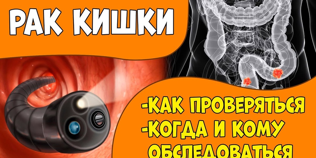 Проверка кишечника на рак в домашних условиях