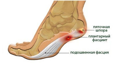 Изображение взято из открытого источника