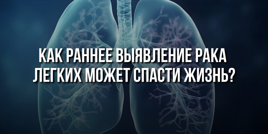 Как раннее выявление рака легких может спасти жизнь?