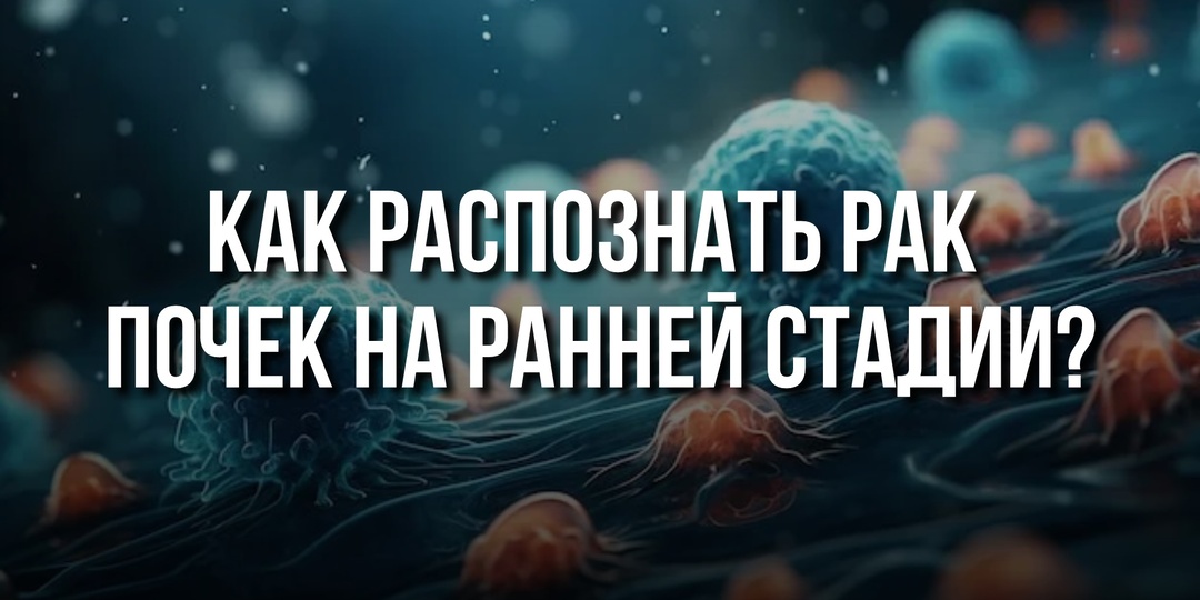 Как распознать рак почек на ранней стадии?