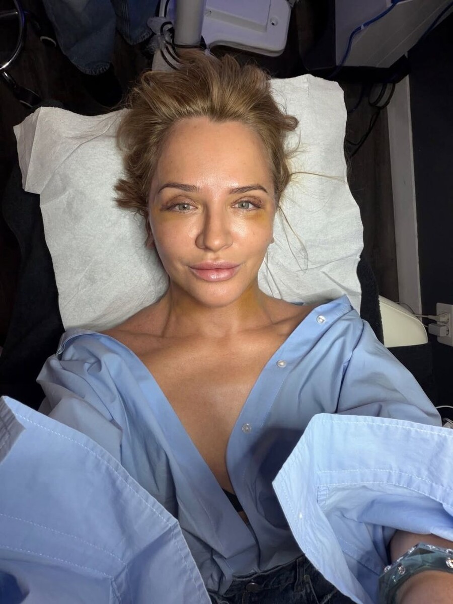    Виктория Шелягова показала результат своей пластической операции. Источник: @vshelyagova*