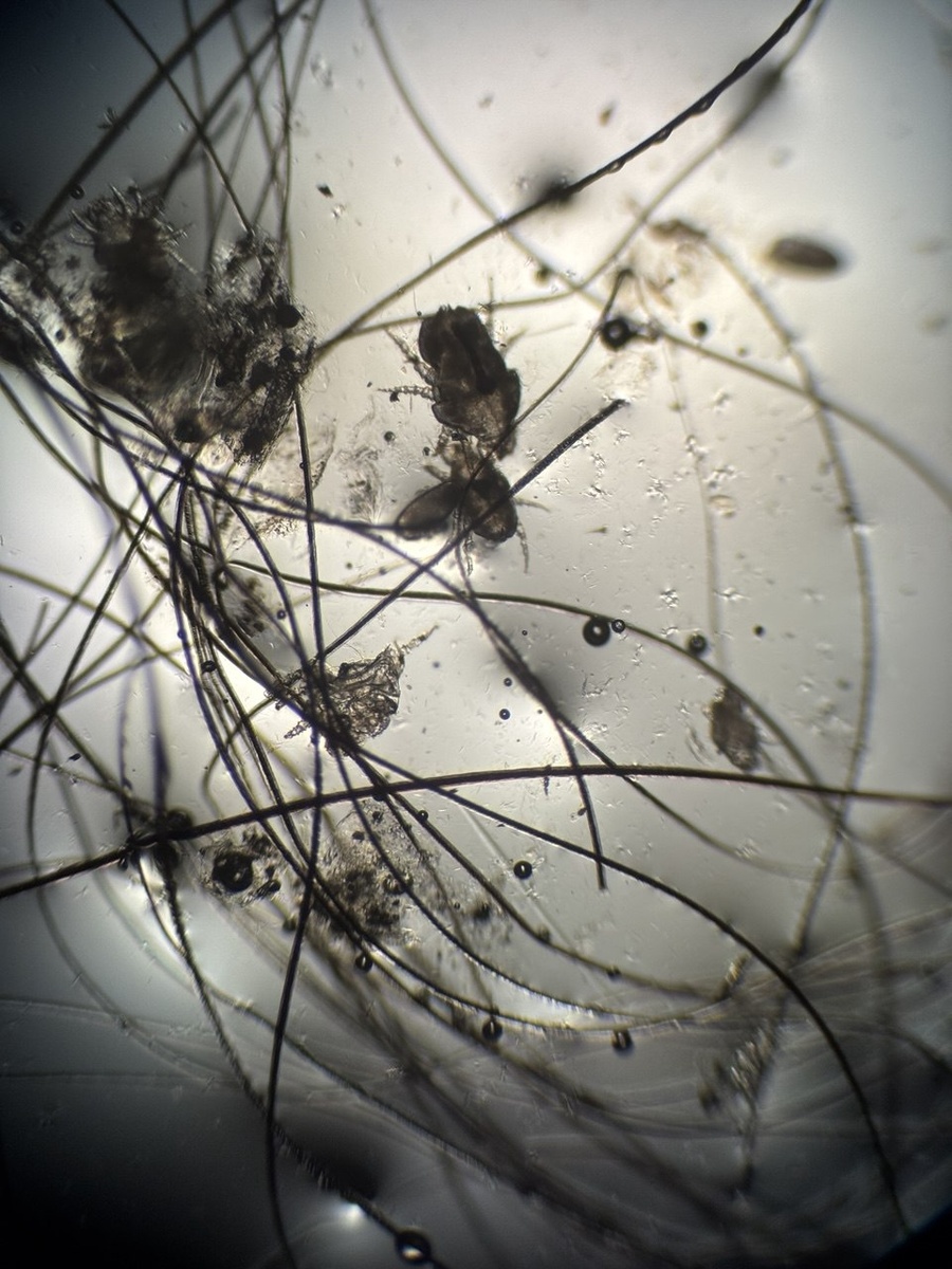 Микроскопия хейлетиелл