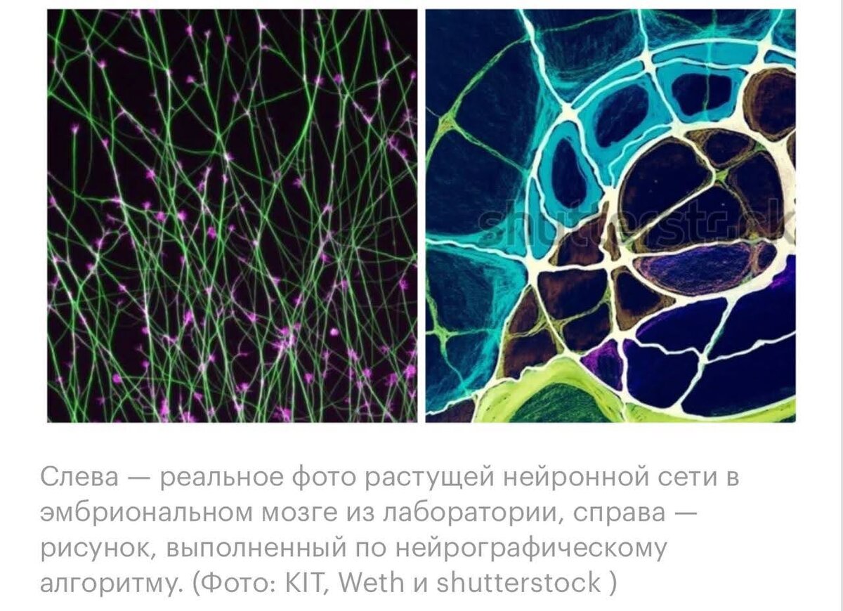 Рисование (графика) тесно связано с процессами, протекающими в мозге, а через рисунок можно оказывать на них прямое влияние. Кроме того, переплетения линий на нейрографическом изображении напоминают связи между нейронами головного мозга.