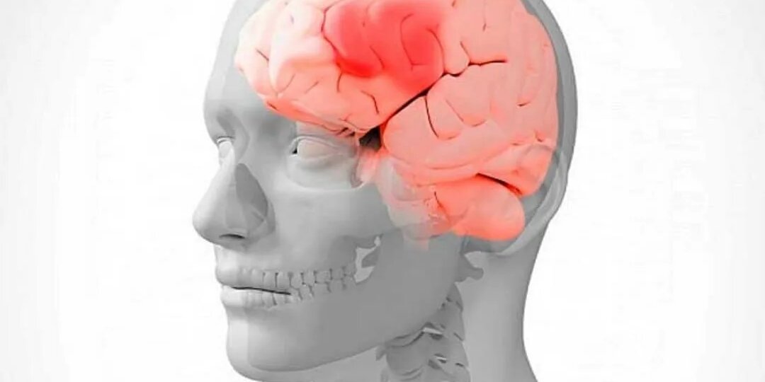 «Просто устал?»: 6 тревожных признаков болезни мозга, которые мы списываем на стресс