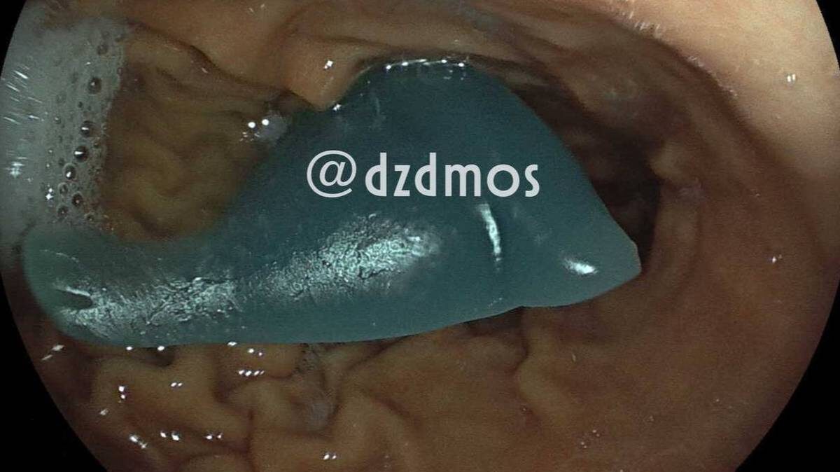    Фото: Telegram / Московская медицина