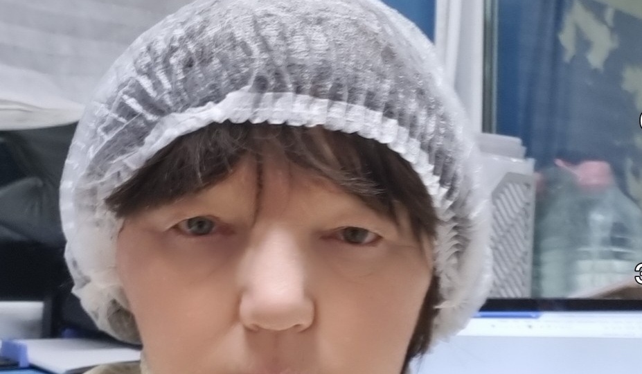 Почему глаза слезятся