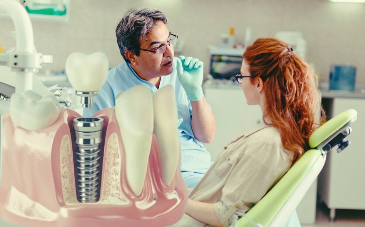 А у вас был опыт установки имплантов?