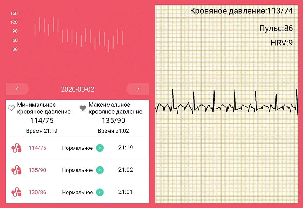 Журнал измерения давления в приложении HEALTHBAND