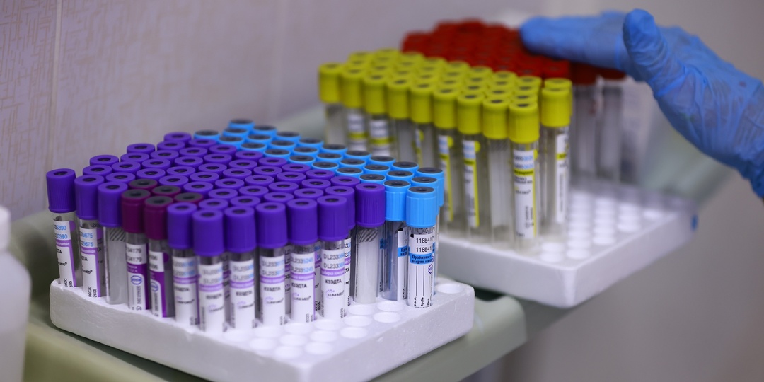 Заражение вирусом Нипах возможно через биологические жидкости, заявил вирусолог