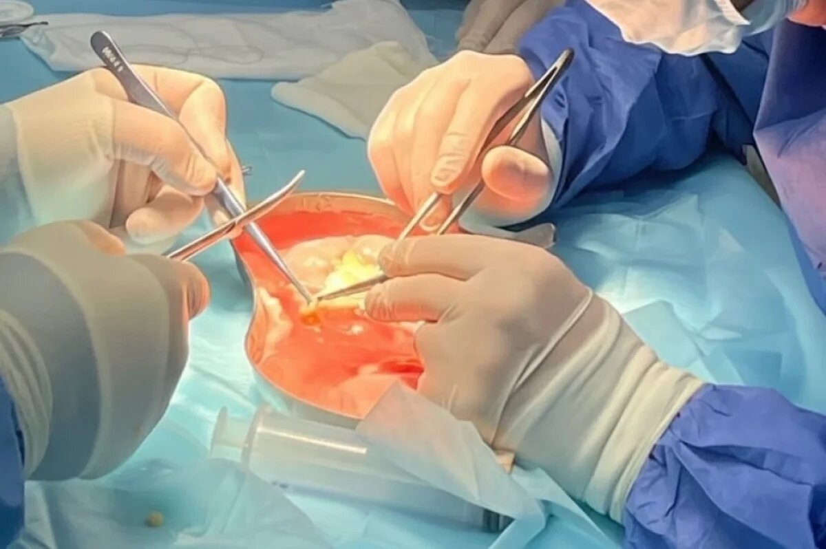    Вторую пересадку почки провели в НОКБ им. Семашко