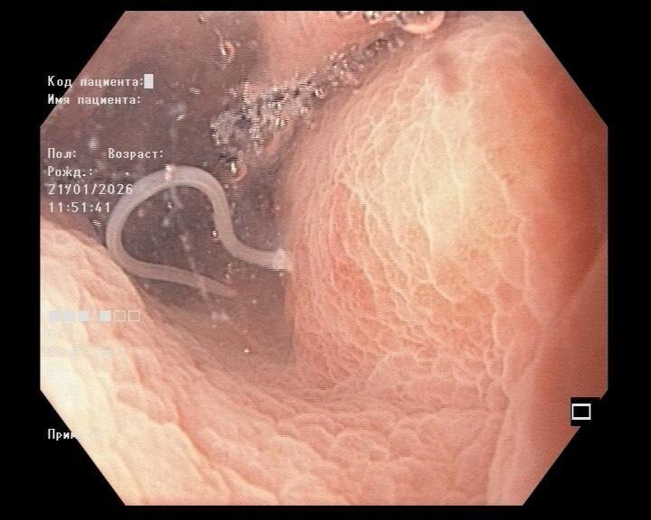 Фото пресс-службы минздрава Приморского краяAdmin  📷
