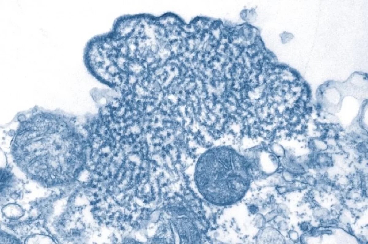    Академик РАН Онищенко оценил показатели смертности от вируса Нипах