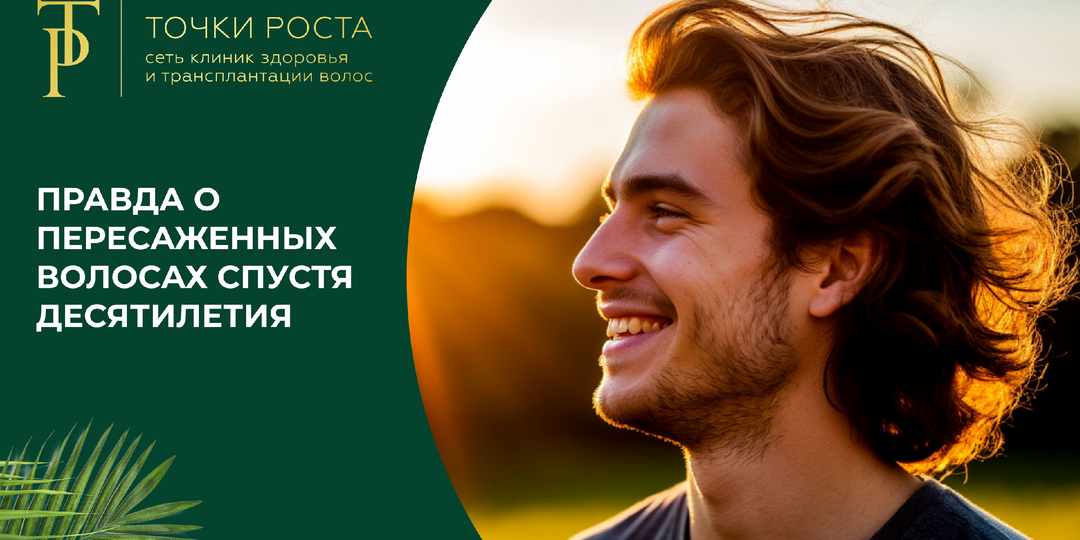 Правда о пересаженных волосах спустя десятилетия