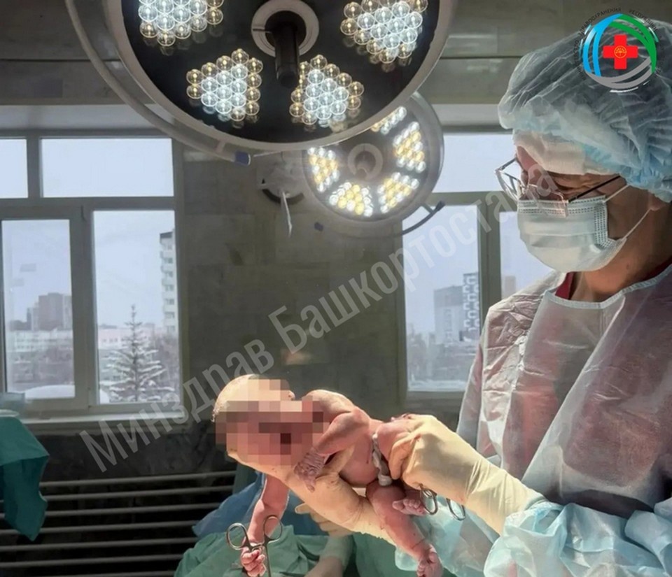    После тяжелых родов мальчик родился рано утром 27 января. Фото: Минздрав РБ