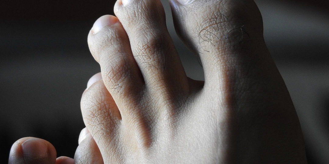 Холодные ноги при диабете: симптом, который появляется задолго до осложнений, когда ещё можно многое изменить