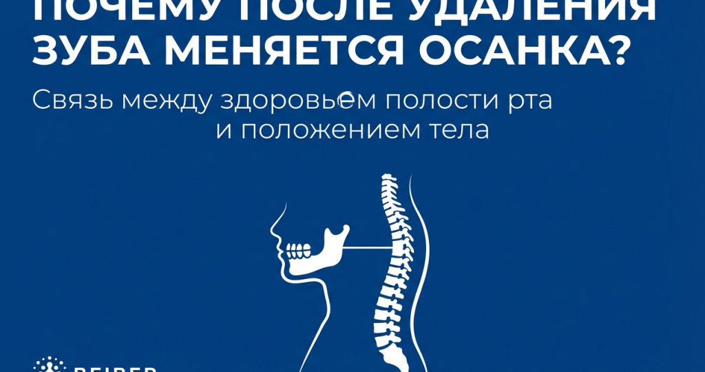 Почему после удаления зуба меняется осанка?
