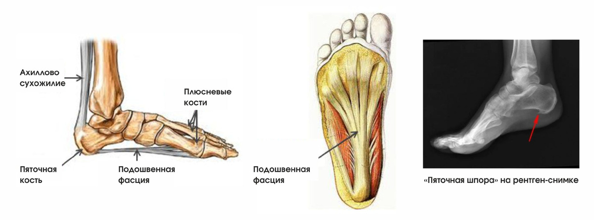 Где на самом деле находится "шпора"