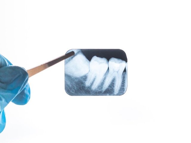    Фото: 123RF.com/annashou