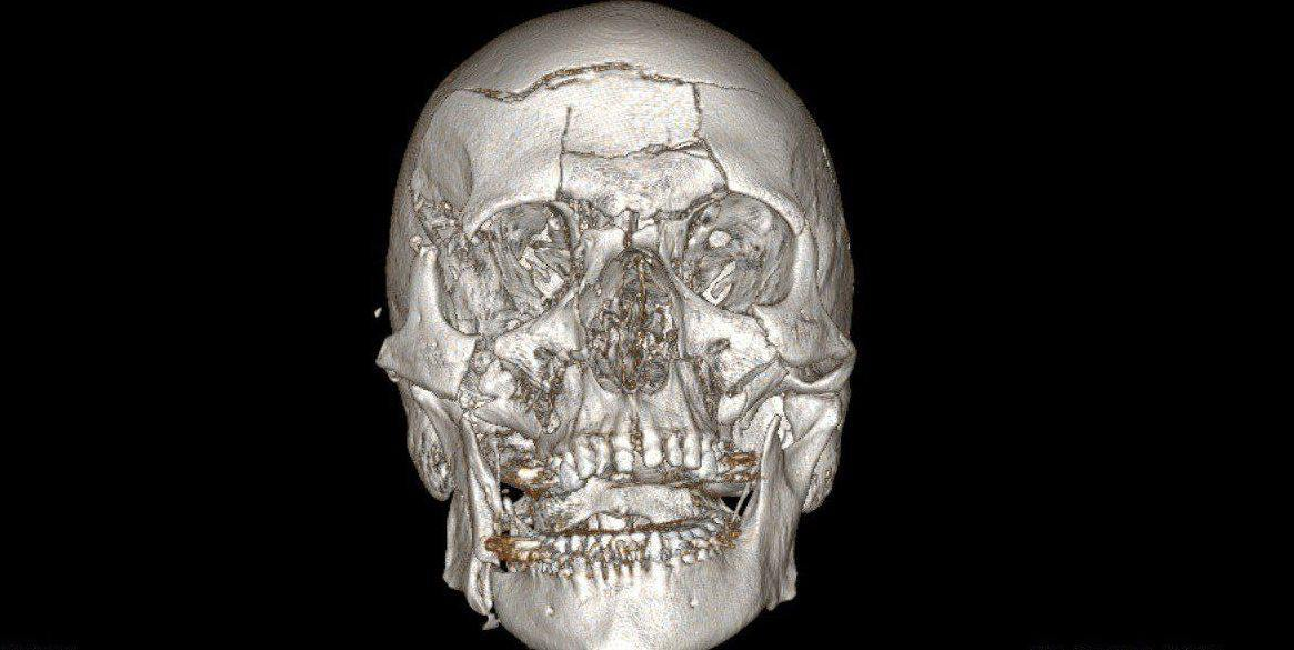 Фото: t.me/minzdravmosreg