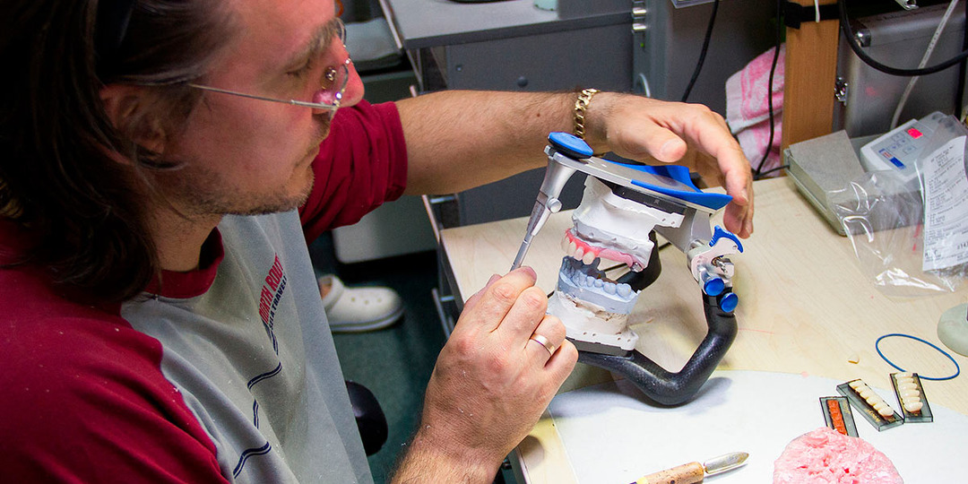 Полные съемные протезы при сахарном диабете как альтернатива имплантации