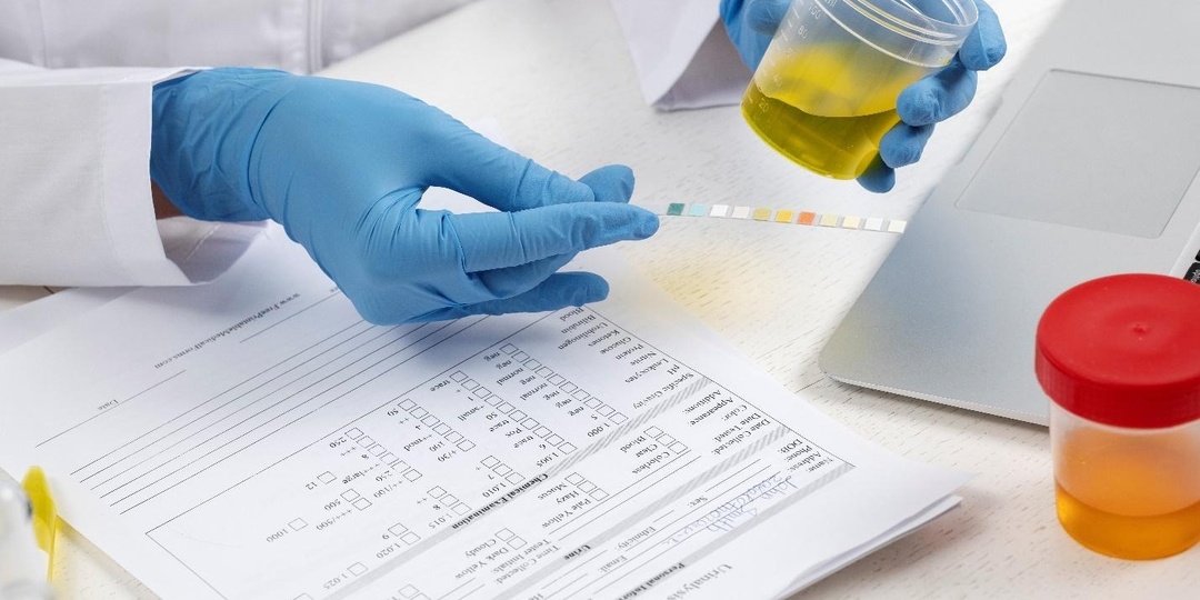 Общий анализ мочи — разбор ключевых показателей