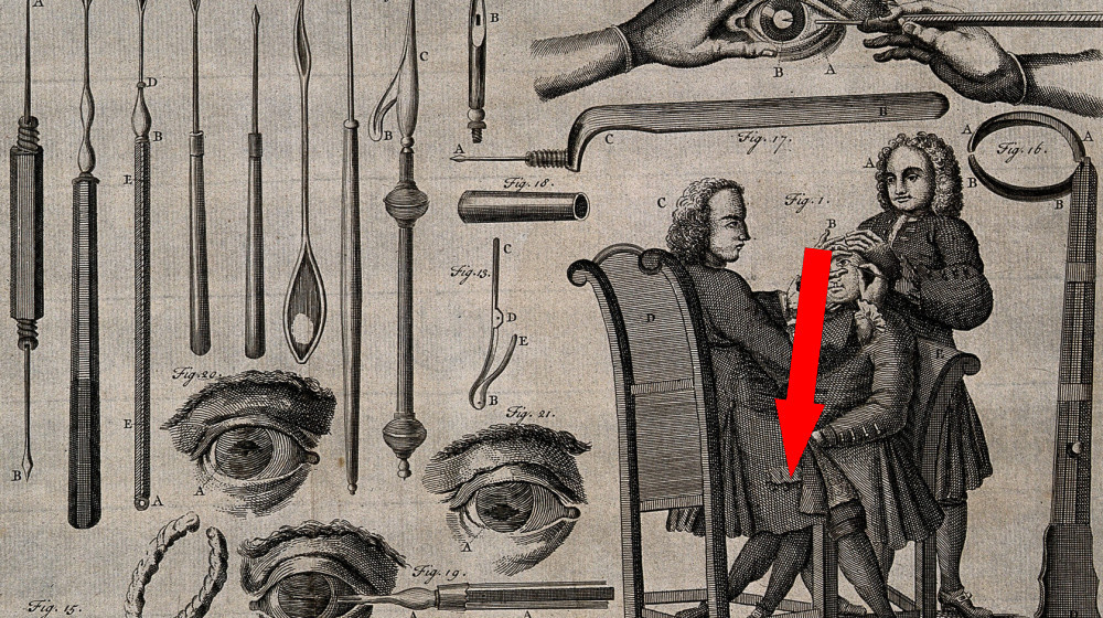    Древний клещ для черепных операций. Тайны 2300-летней находки в Польше