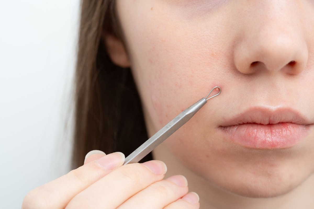    Фото: Istock/Arina Dovlatova