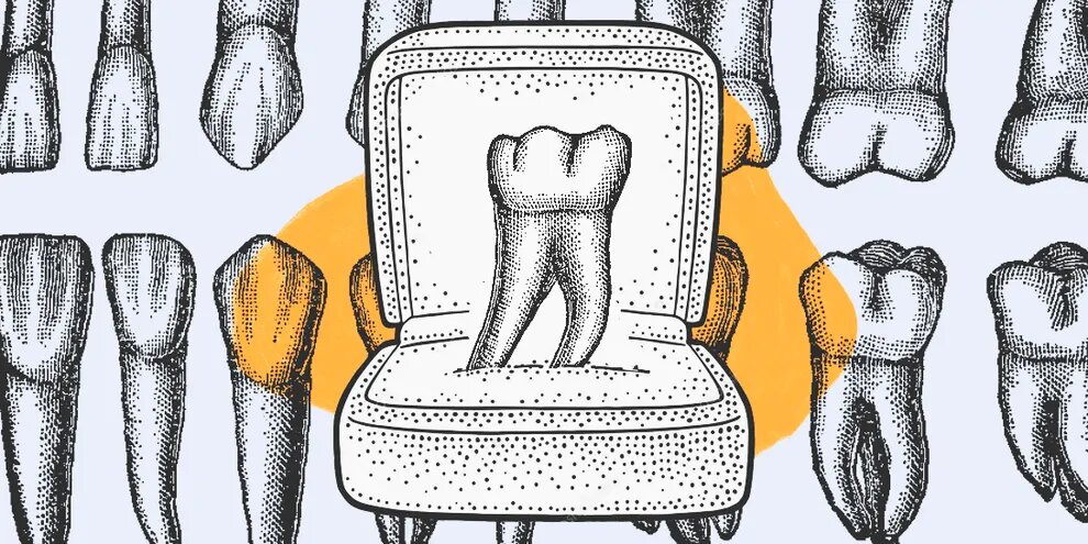 Удаление зубов в качестве свадебного подарка