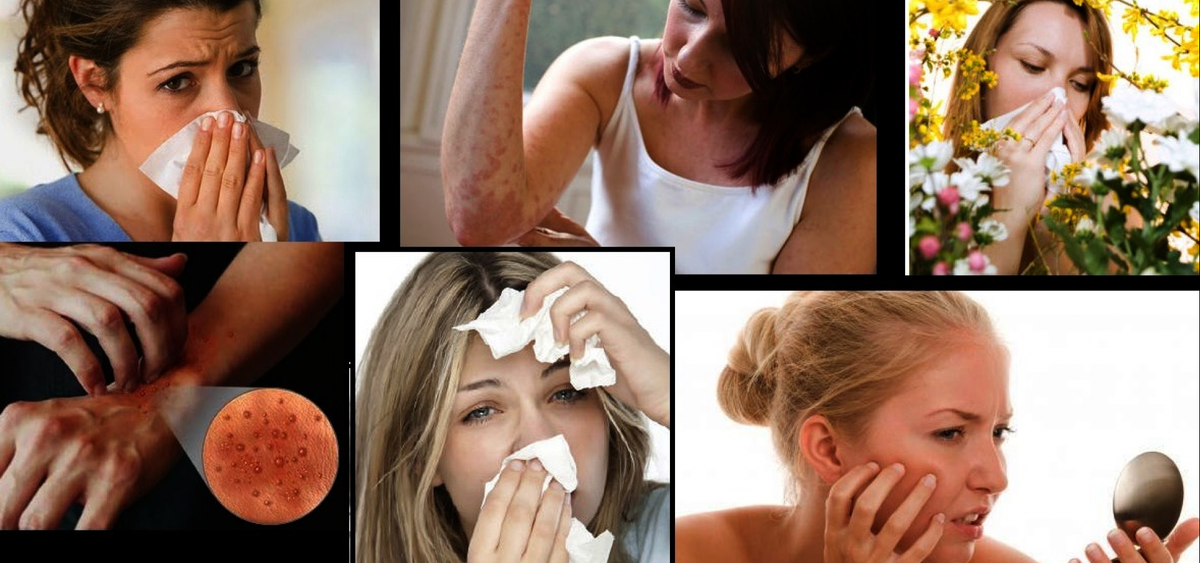 Аллергия и движение: как помочь организму без таблеток