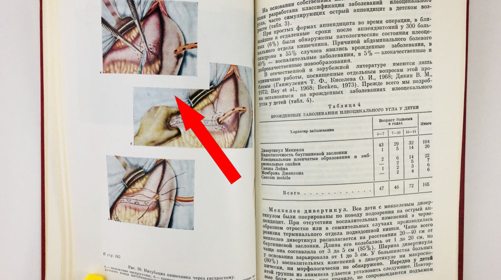    Шок в школе: почему ребенка не отпустили с болью в животе и что с этим делать