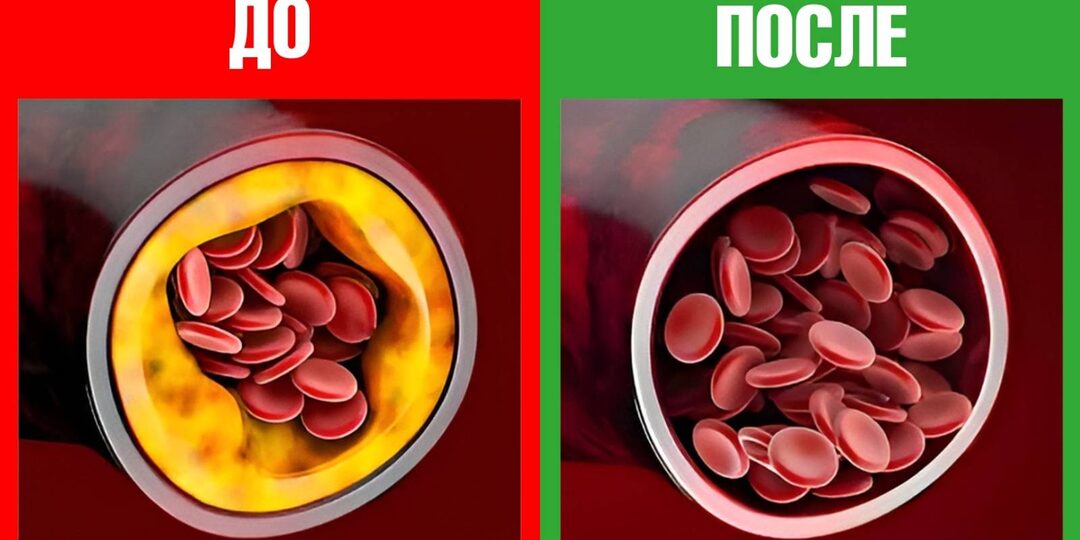 Лучшие продукты для сердца
