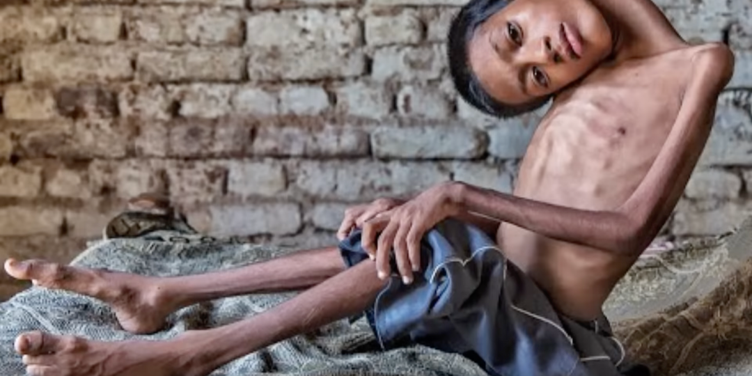 Они родились не как все. Истории детей, которые невозможно забыть