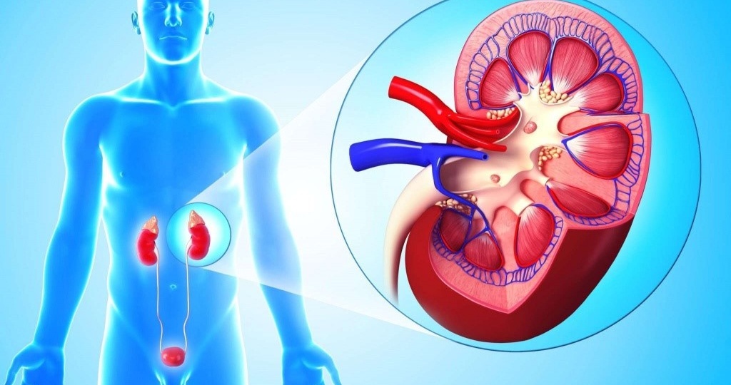 Как распознать пиелонефрит, пока он не стал хроническим