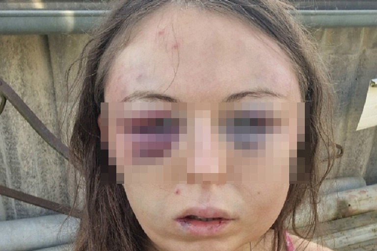 Житель Ржева периодически избивал бывшую подругу. Теперь ответит