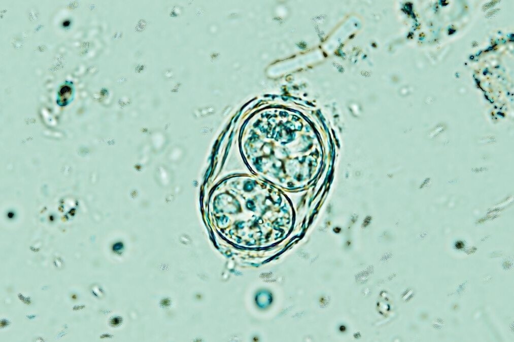     Спящий паразит токсоплазма в мозге оказался активнее, чем считалось раньше