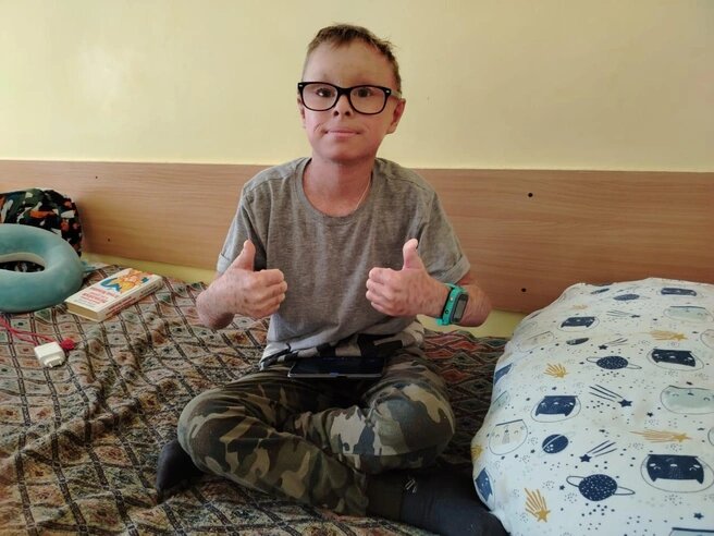 Ярослав родился с ихтиозом: его кожа очень сухая и постоянно нуждается в увлажнении