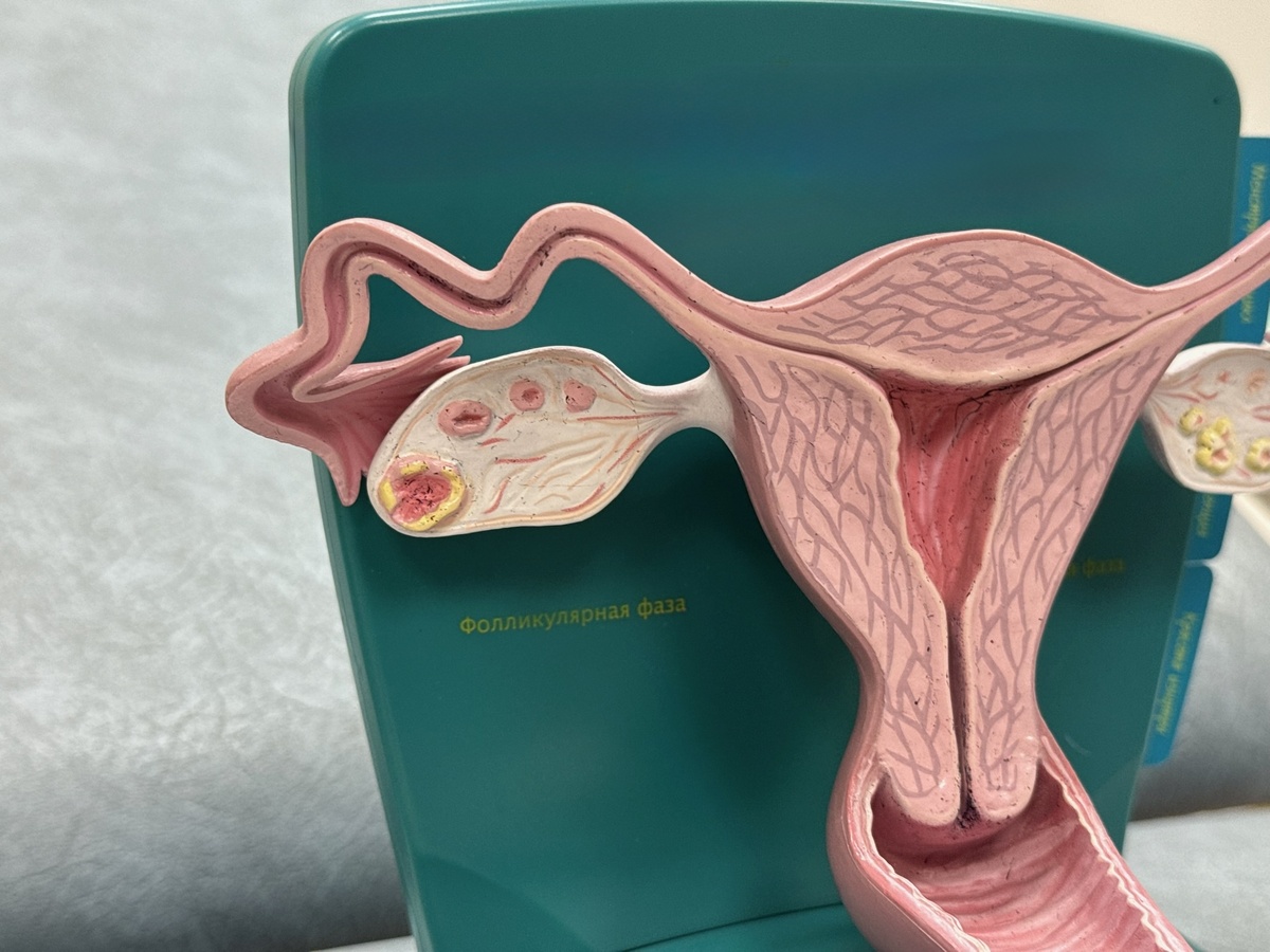 Фото с сайта "Екатеринбургский медицинский центр"