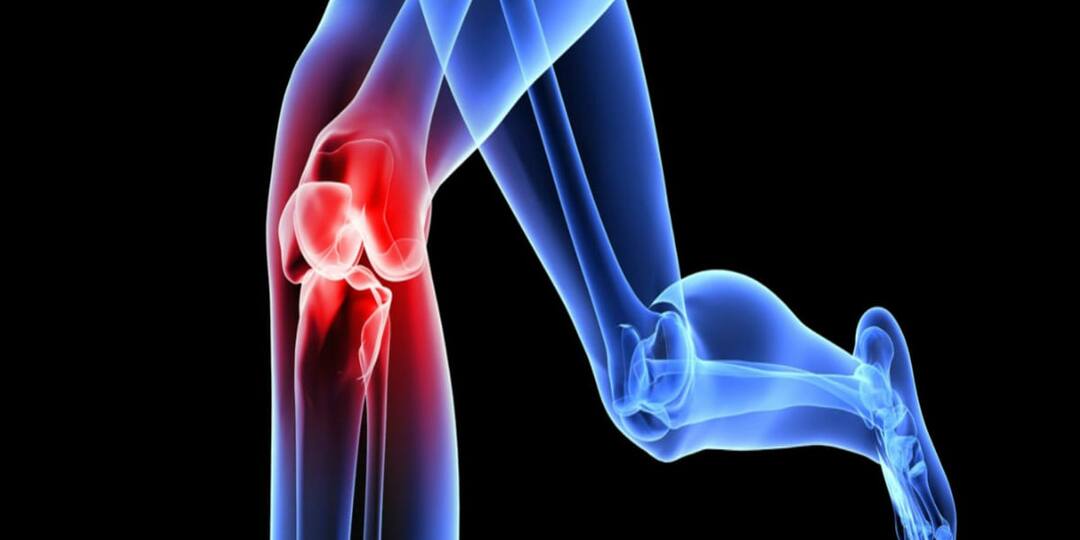 Хондропротекторы: Мифы и Реальность о Здоровье Суставов