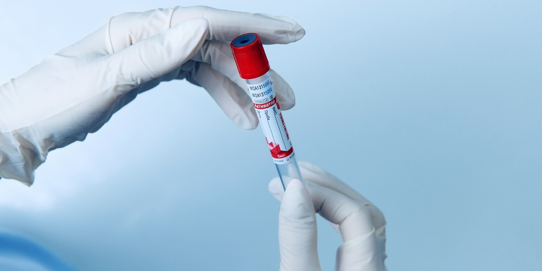 Почему у женщин холодные руки и ноги - и при чём здесь гормоны ?